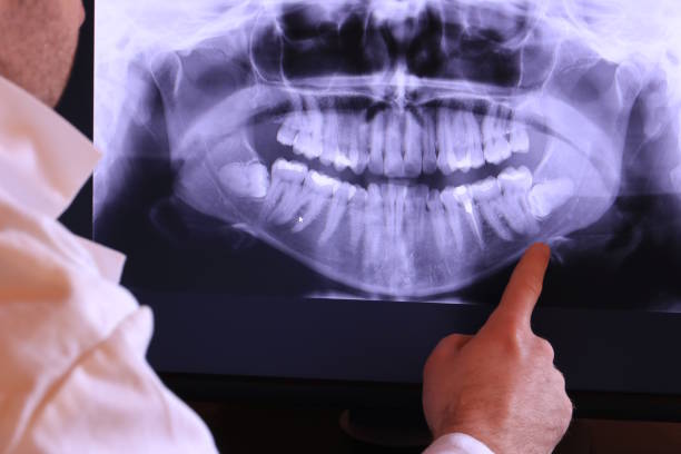 Best Walk-In Emergency Dentist in Coon Rapids, IA