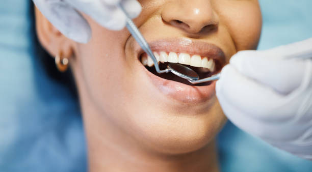 Best Emergency Tooth Extraction in Coon Rapids, IA